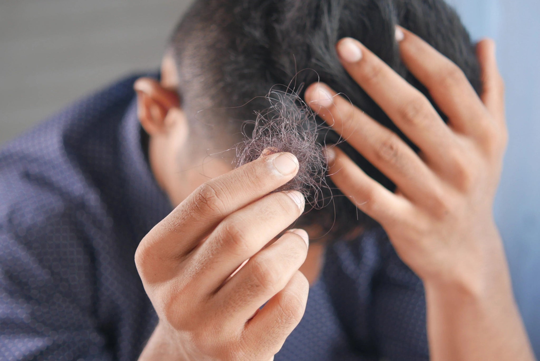 Hair Loss Treatment in Singapore: The Ultimate Guide to Solutions, Costs, and Clinics (2025 Edition) - TwoHerbs