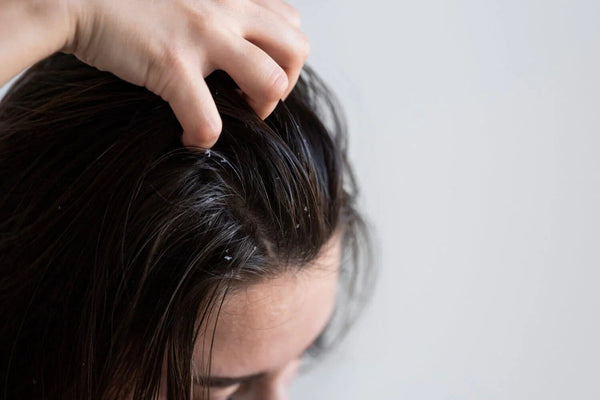 Oily Scalp, Dry Hair, And Other Hair Woes: 3 Tips - TwoHerbs