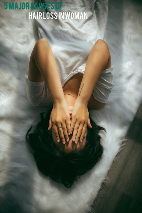5 Major Causes Of Hair Loss In Women