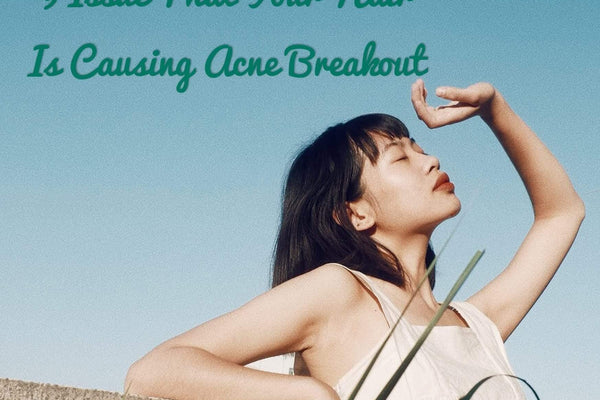 9 Issue That Your Hair Is Causing Acne Breakout - TwoHerbs