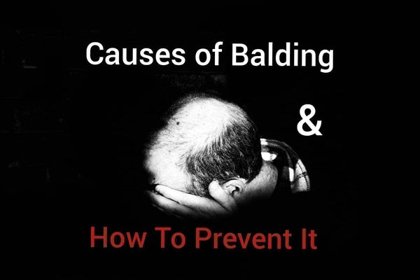 Causes of Balding & How To Prevent It - TwoHerbs
