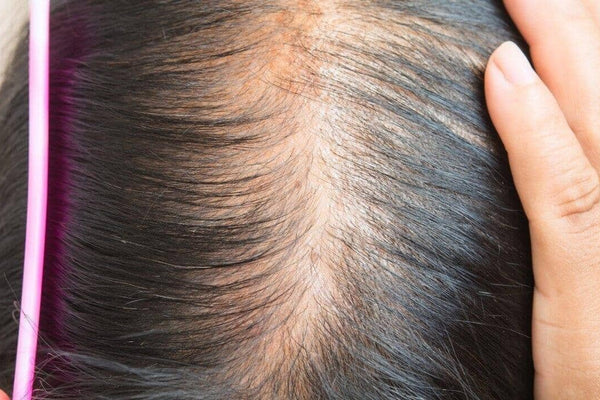 Early Signs of Hair Thinning - TwoHerbs