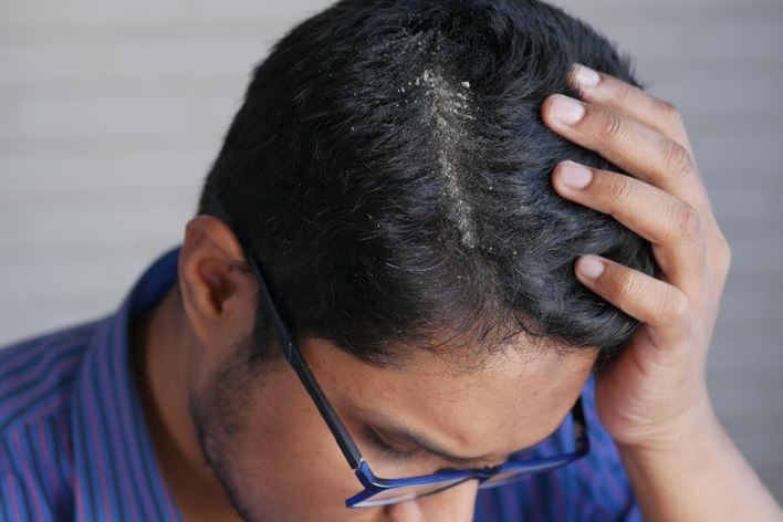 How To Do Scalp Treatments At Home: 6 Tips