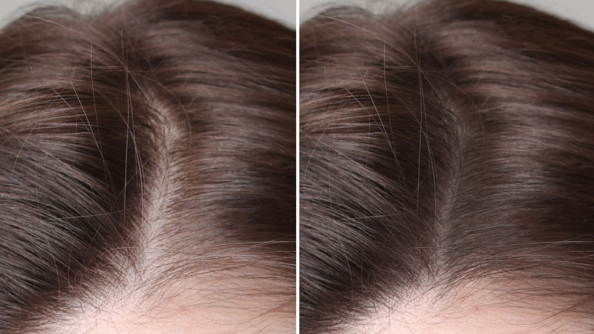 Is Hair Loss Reversible? What You Need to Know - TwoHerbs