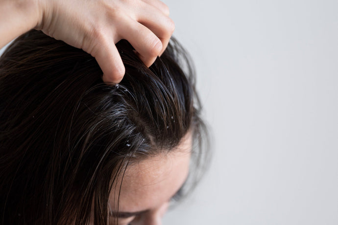 Oily Scalp, Dry Hair, And Other Hair Woes: 3 Tips