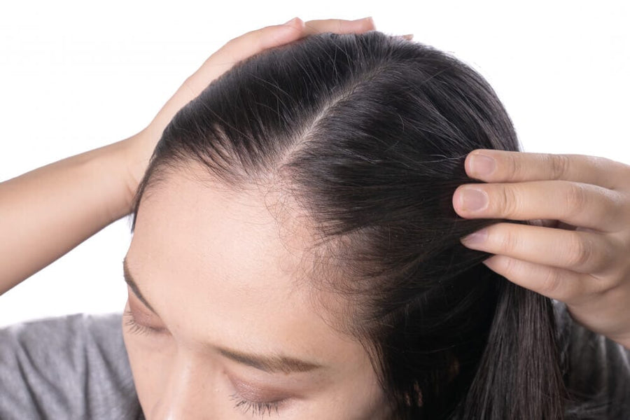 Why Does My Scalp Hurt? 6 Crucial Facts You Must Read [2023]