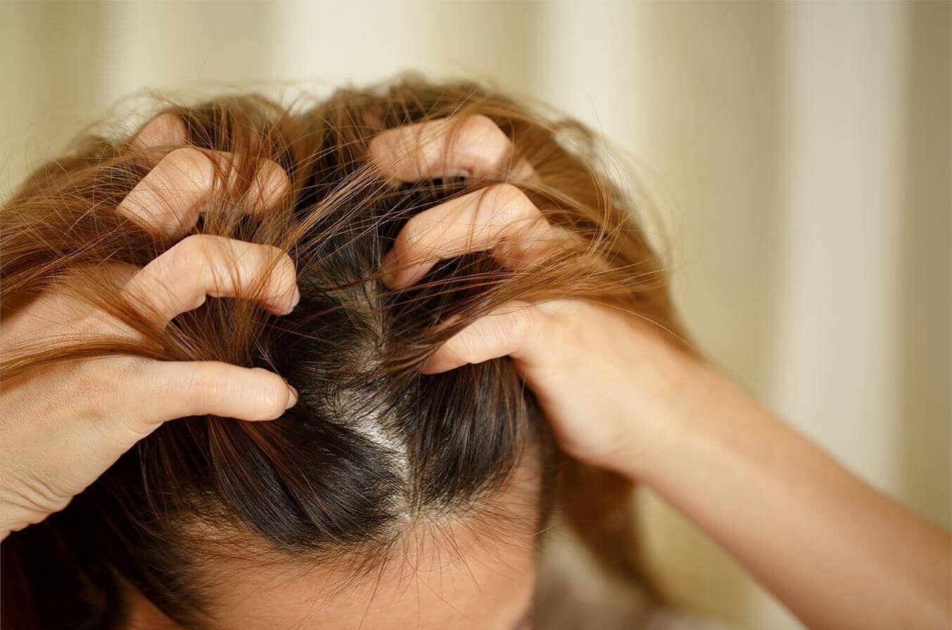 Why Is My Scalp Itchy? Top 18 Reasons - TwoHerbs