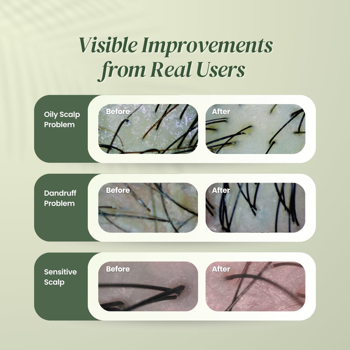 Hair Fall Rescue Tonic | Best Hair Growth Booster - TwoHerbs